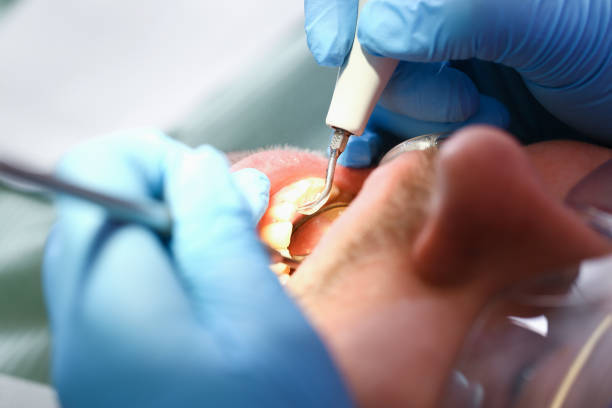 Best Emergency Dental Care for Broken or Chipped Teeth in Pineville, KY