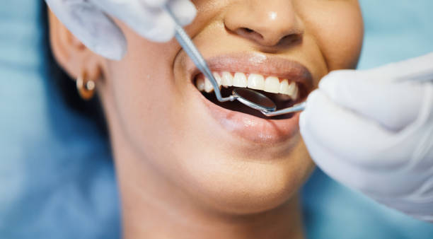 Best Emergency Dental Care for Broken or Chipped Teeth in Pineville, KY