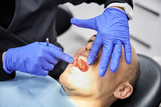Best Emergency Wisdom Teeth Removal in Pineville, KY